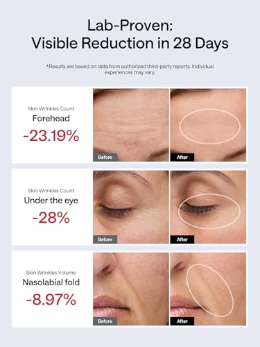 JMOON NouvelleSkin M30U PR Facial Toning Device, FDA-Cleared Microcurrent & Red Light Therapy T368584