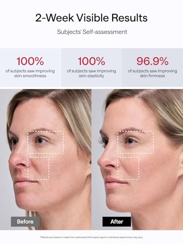 JMOON NouvelleSkin M30U PR Facial Toning Device, FDA-Cleared Microcurrent & Red Light Therapy T368584